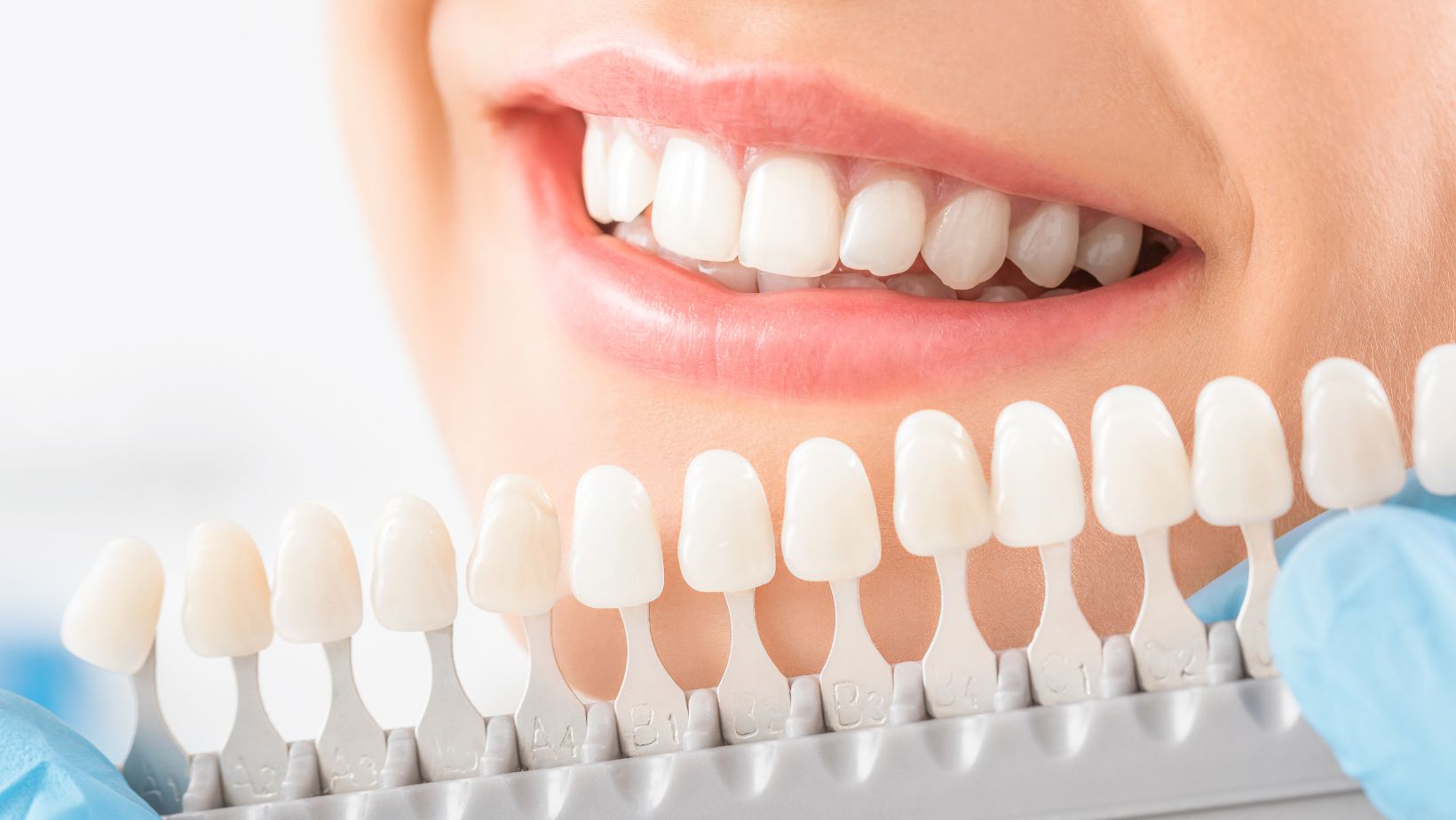 Top 5 Benefits Of Collaborating With Private Label Teeth Whitening Manufacturers